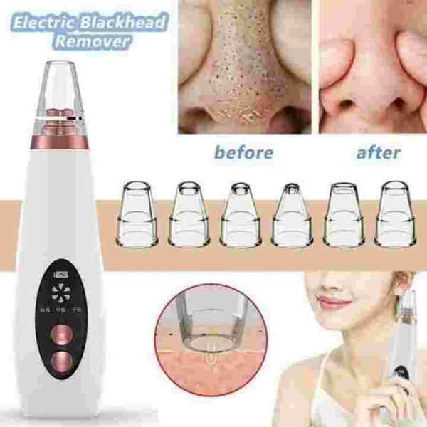 Blackhead remover machine - Image 5